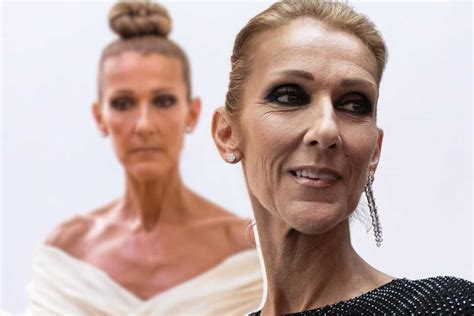 è vero che è morta celine dior|Cos'è la sindrome della persona rigida, la malattia che .